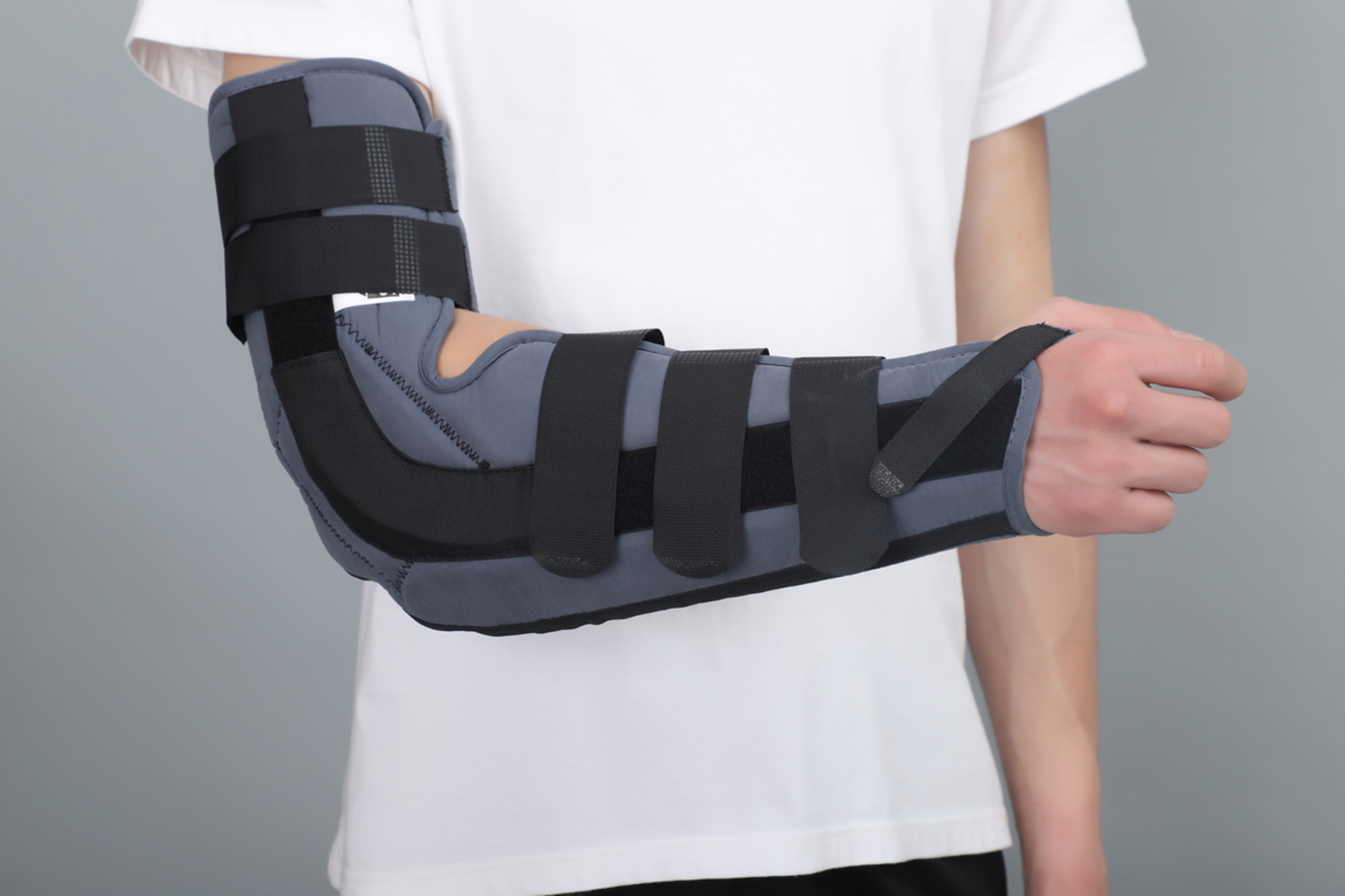 Quality Hook And Loop Supracondylar Fracture Splint Aluminum Stay FDA Approved for sale