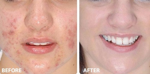 New design 4S multiple 2 display Beauty Machine-IPL&RF&E-light&Nd:YAG laser system