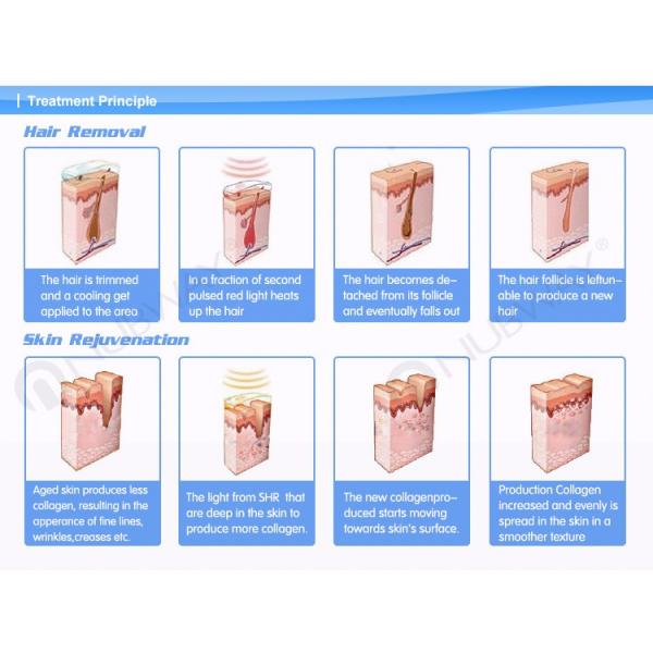 TUV medical CE approved IPL hair removal SHR skin rejuvenation machine