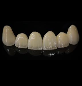 Quality Comfortable Zirconia Crown With Good Fitting And Precision Esthetics for sale