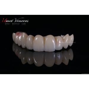 Quality Natural Bright White Veneers for sale