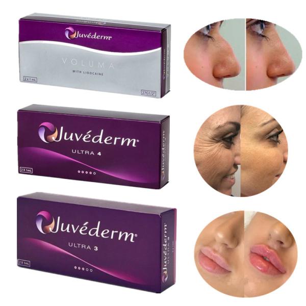 Juvederm 8-12 Months Hyaluronic Acid Dermal Filler Revolutionary Injectable