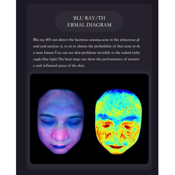 100V-240V Facial Skin Analyzer Machine Comprehensive Skin Evaluation AI Powered Diagnosis