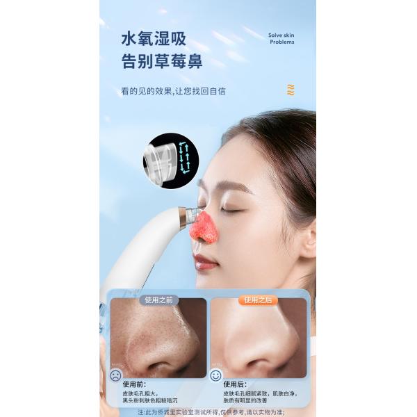 Soft Silicone Probe Deep Cleansing Facial Machine 3 Gears Pore Suction Device OEM