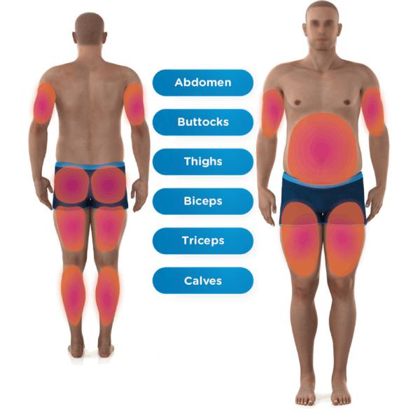 4 Handle RF Muscle Sculpt Fat Reduce Manufacturer EMS Sculpt RF Body Sculpt Machine