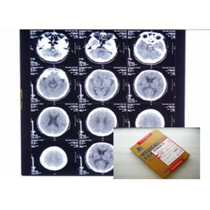 China PET Medical Digital X Ray Film Stable With Agfa / Fuji Thermal Printers on sale