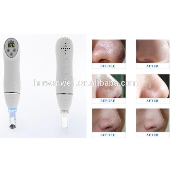 Diamond microdermabrasion machine for removal the aging keratin