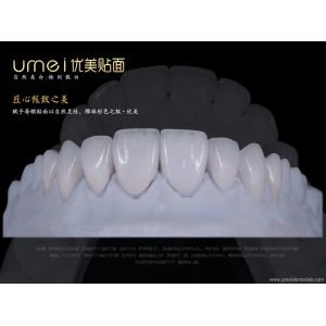 Quality Ultra-thin aesthetic dental veneers for sale