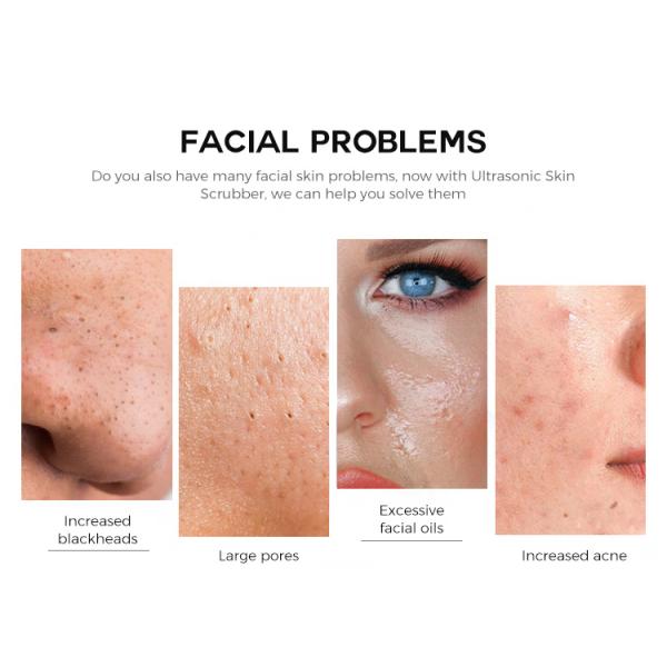 3 Modes Exfoliators Ultrasonic Facial Skin Scrubber ABS Material