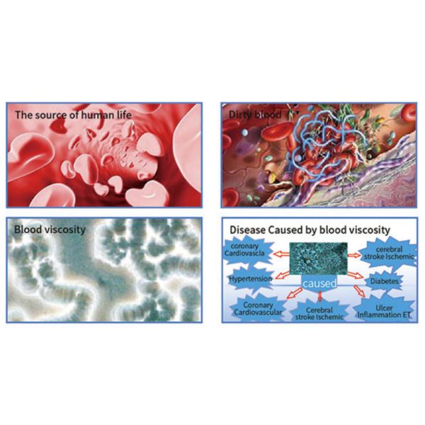 LLLT 450nm 660nm Reduces Blood Viscosity Laser Watch For Diabetes Elderly Use