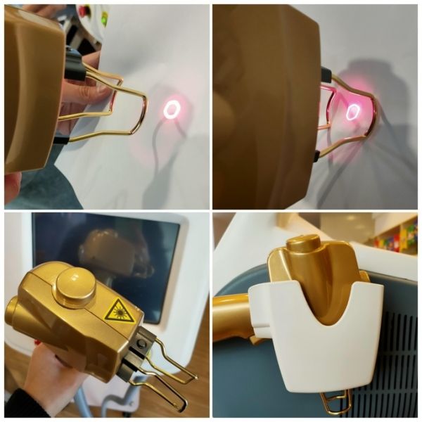 Microcomputer Controlled Er YAG Laser Resurfacing Machine for Skin Rejuvenation