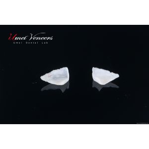 Quality Customized ultra-thin dental veneer for sale