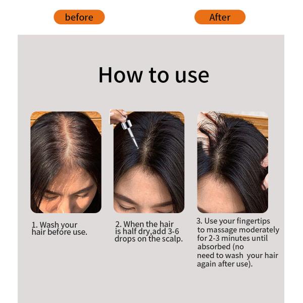 30ml Hair Growth Serum