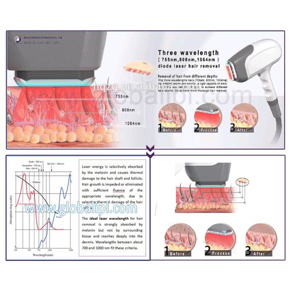 3 wavelength diode laser2.png