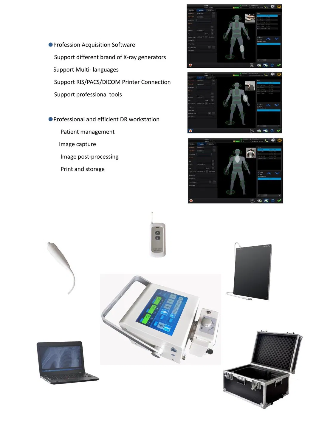 STXR-Y100 Digital Portable X Ray Machine High Frequency For Clear And Detailed Imaging