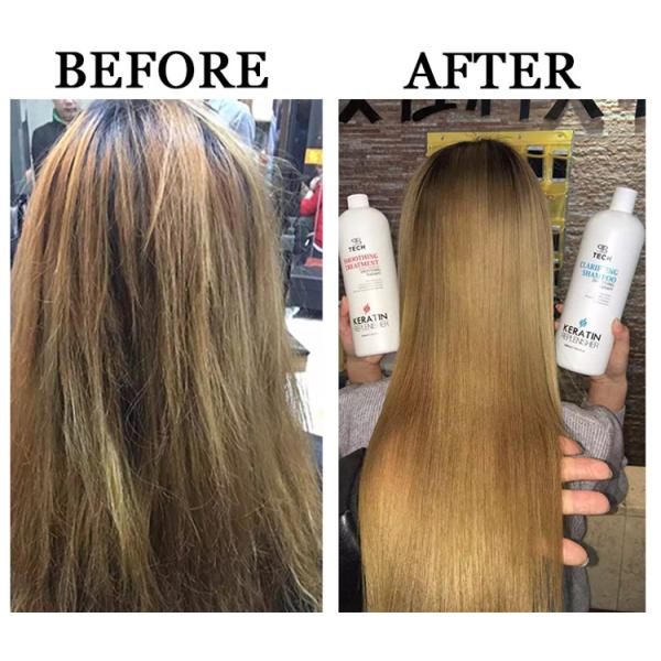 Anti Hair Loss Dandruff Hair Shampoo Organic Natural Hair Care