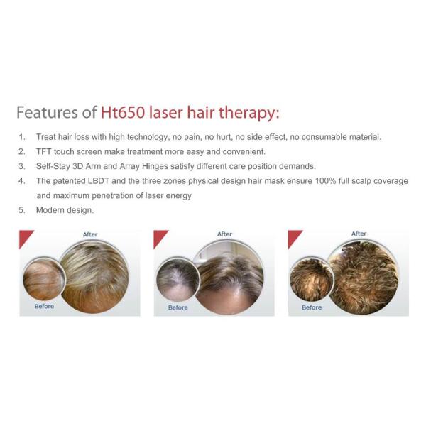 Diode Laser Hair Growth Machine 650nm Low Level LLLT Hair Loss Treatment