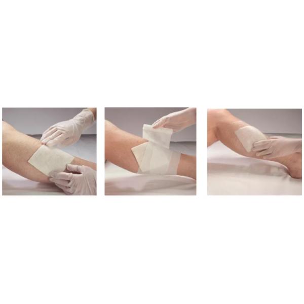 CE Sterile Calcium Alginate Pads 10x10cm Breathable