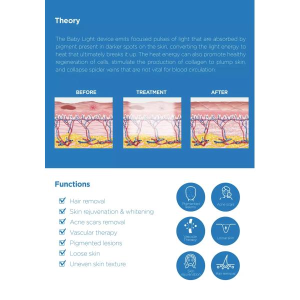 ADSS Most Effective Professional BBL Elight Painfree Opt Elight Beauty Machine