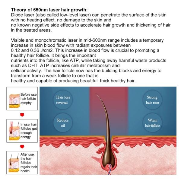 Diode Laser Hair Growth Machine 650nm Low Level LLLT Hair Loss Treatment
