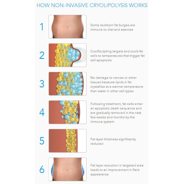 4 in 1 technology best selling effective china cryolipolysis