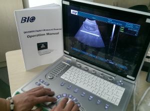 Quality PC Based B / W Portable Ultrasound Scanner 15 inch Laptop Screen Only 5kgs Weight Convenient to Carry for sale