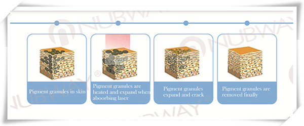 1064nm/532nm portable home laser tattoo removal machine for tattoo removal