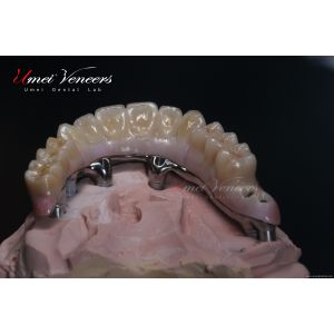 Quality Robust zirconia planted bridges for sale