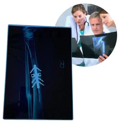 Water Resistance 8*10 Inch PET Blue Based X Ray Medical Film For Image Inkjet Printing