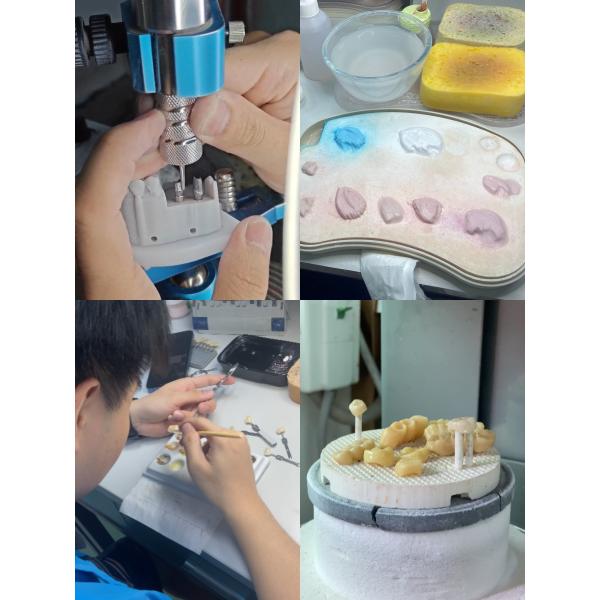 Replace Missing Teeth Dental Implant crown With Screw Titanium Base And Zirconia Crown