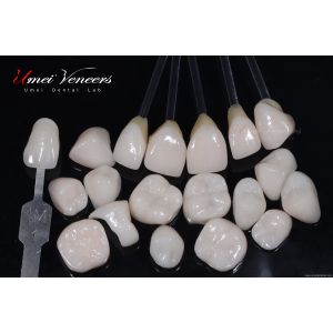 Durable Whitening porcelain veneer