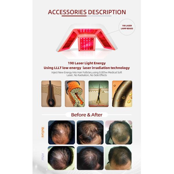 5 In 1 Laser Hair Growth Machine 650nm Diode Therapy Beauty Salon Equipment