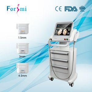 Quality 2016 Hot Sale HIFU face lift&amp; skin tightening machine for sale