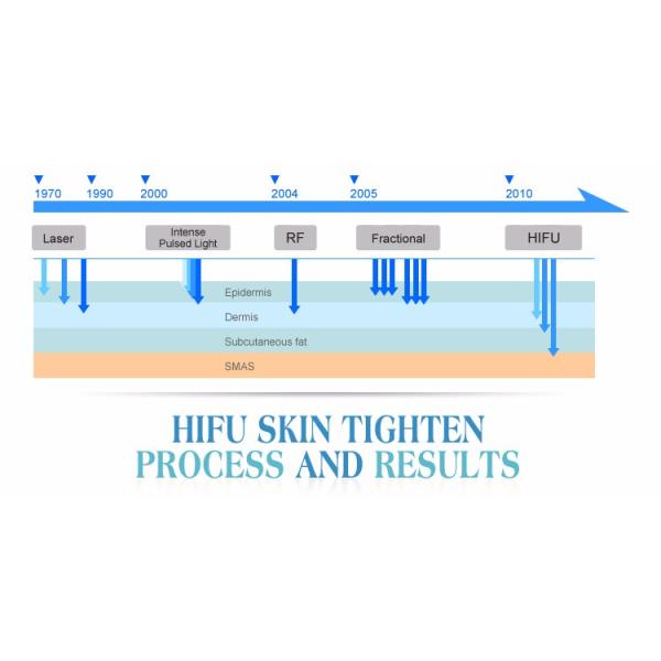 Skin Tightening / HIFU Face Lift / HIFU Equipment For Wrinkle Removal 110v 220v