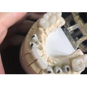 Metal Free White Zirconia Dental Crowns Excellent Biocompatibility