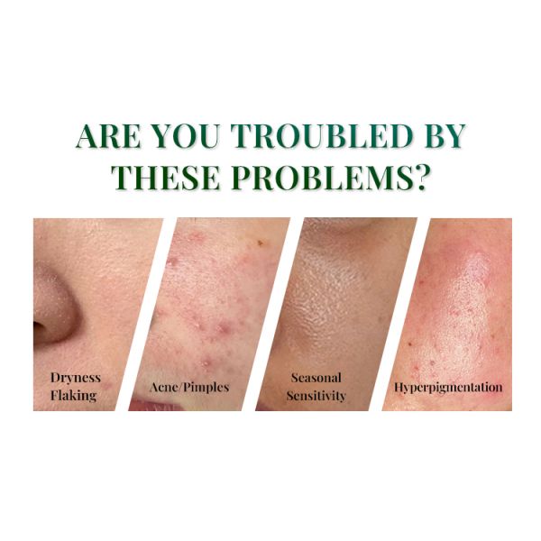 OEM ODM Strong Hydrating Moisturizing Serum Small Bottle Hyaluronic Acid Acne Treatment Skin Serum