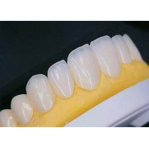 Quality EMAX Porcelain Veneer with Stain Resistance for Natural looking Esthetic Restorations for sale