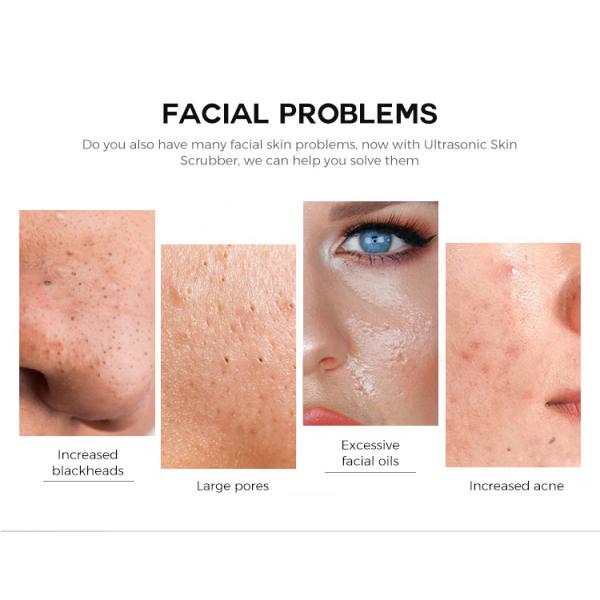 Exfoliator Ultrasonic Skin Facial Beauty Device For Blackhead Removal