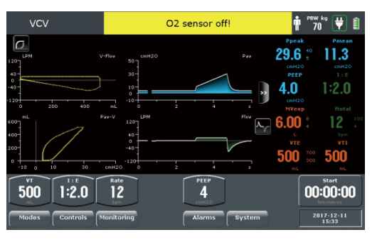 X30 Anesthesia Workstation with 4 tube flowmeter, peep valve, N2O+O2, white color, one drawer, two vapoirzer