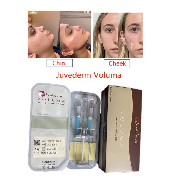 Juvederm Voluma Crosslinked Hyaluronic Acid Filler Long Lasting Face Pure Injectable