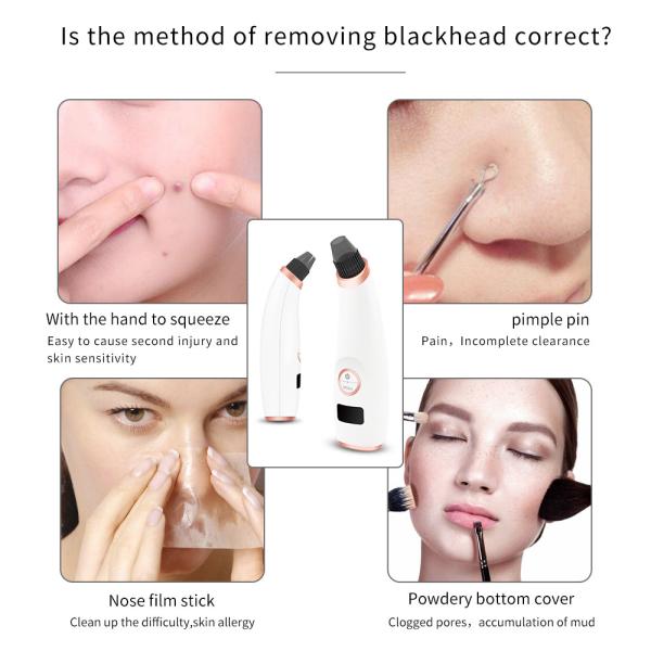 Multi Function Fcial Pore Cleanser Blackhead Acne Remover Electric Vacuum Suction Tool