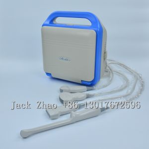 Quality China Portable Ultrasound Machine Price for sale