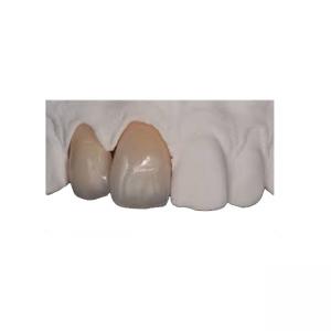 China Body Strength Thin Zirconia Crown Durable Natural Realistic Restoration on sale