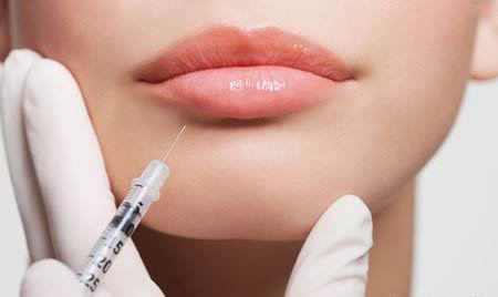 Cross Linked Sodium Hyaluronic Acid Injection Dermal Filler For Lip Fullness Facial Wrinkles