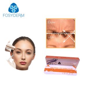 China Syringe Packaging Hyaluronic Acid Facial Filler Smooth Texture MOQ 1Box on sale