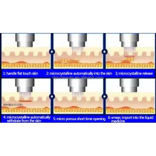 Secret Portable Radiofrequency Facial Skin Tightening RF Fractional Microneedle RF Microneedling For Acne Scar Removal