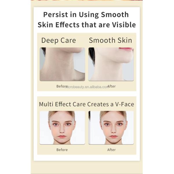 Home Face And Neck Lifting Massager V Face Lifting Massager For Skin Tighten Whitening