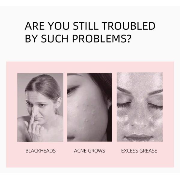 53kPa 3W Facial Vacuum Suction Machine Pore Cleanser Machine Replaceable Head