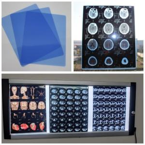 China Blue Base Medical Inkjet Dry Film For Digital X Ray Image With 210microns A3 13x17 on sale