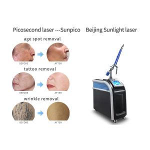 Quality Vertical Picosecond Laser Tattoo Removal Machine Pigmentation Removal Acne Treatment for sale